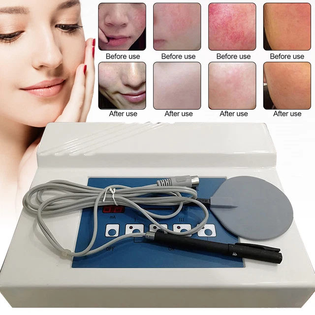 HIGH FREQUENCY SPIDER Veins Removal Anti Redness Machine Red Blood
