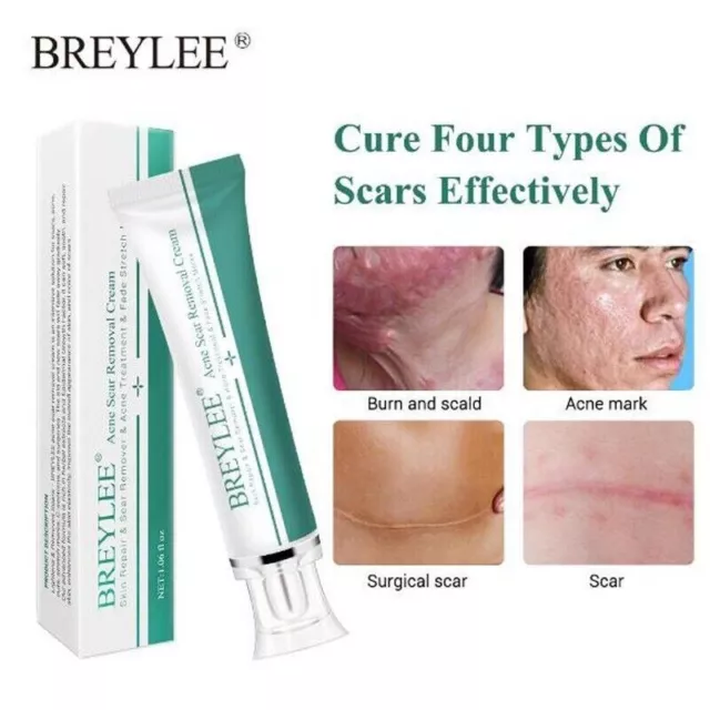 Breylee Acne Scar Removal Cream 30G Face Cream Skin Repair Skin Care Scar Acne