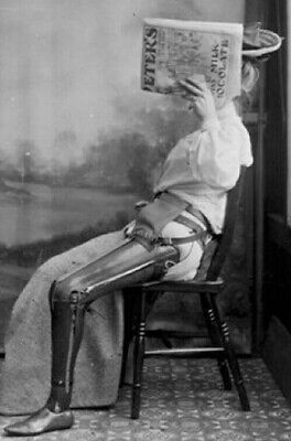 Antique Medical Prosthetic Photo 389b Odd Strange & Bizarre