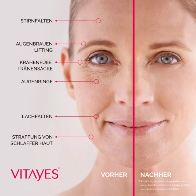 vitayes, Instant ageback, Lifting Creme (7ml) – glatte Haut in nur 5 Minuten. 2