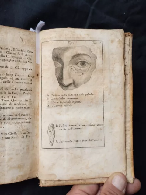 1755 Le Dran- Osservazioni Di chirurgia - Incisioni- Bologna Colle Ameno