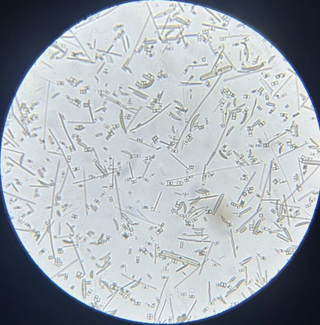 J.D. Moller Microscope Slide Diatom Fossil Leghorn Earth Italy Gold Medal 1869