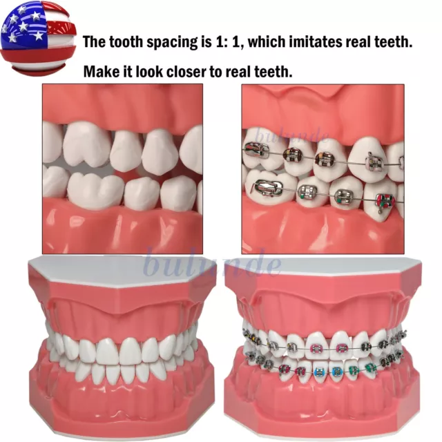 US Dental Orthodontic Teaching Study 1:1 Typodonts Teeth Model