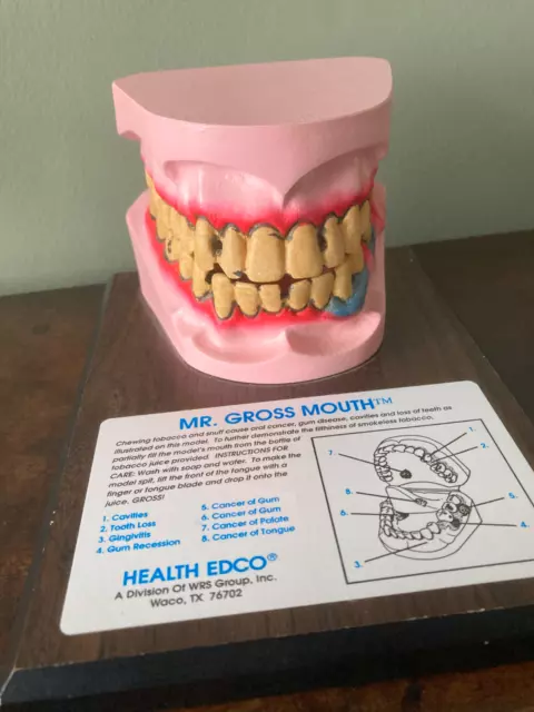 Rare Mr Gross Anatomical Model Of A Diseased Mouth