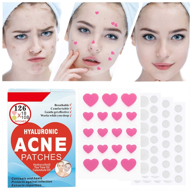 Pegatinas para eliminar el acné parche facial para espinillas para acné corrector facial