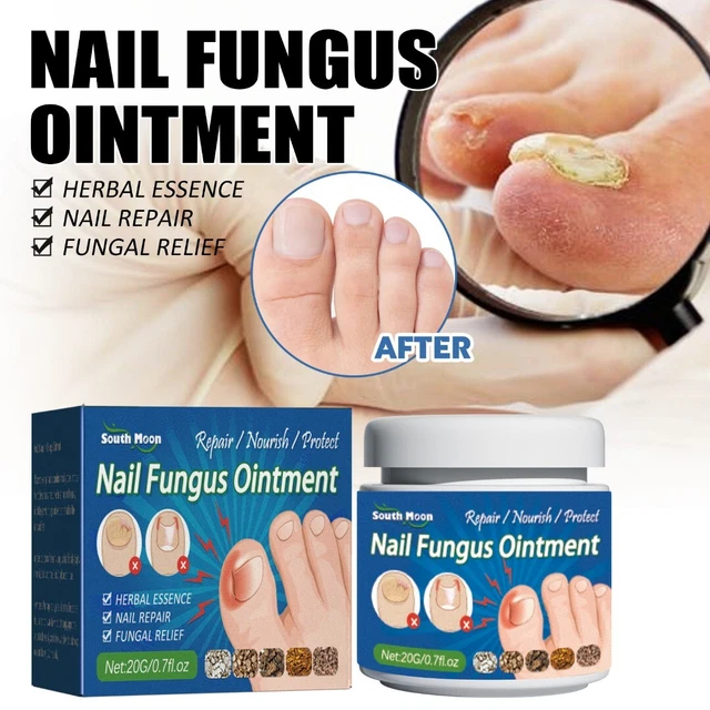 NAIL FUNGUS REMOVAL Cream Anti Fungal Foot Nails Repair Treatment