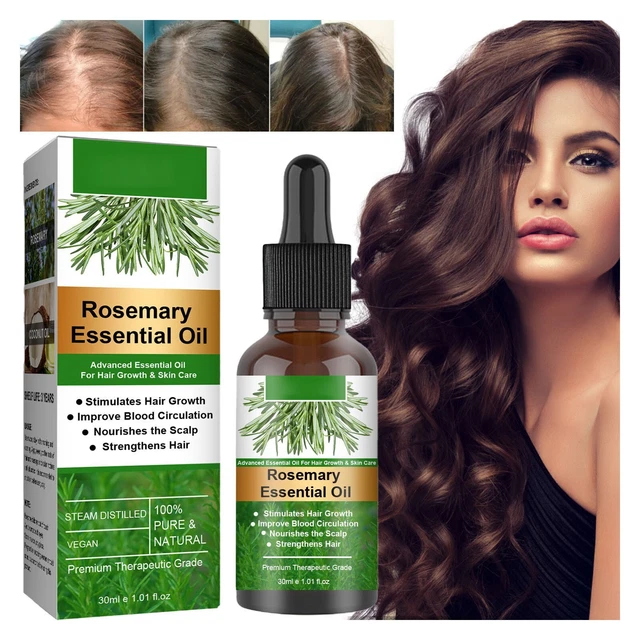 2 piezas de aceite de romero para el crecimiento del cabello cuidado de la piel nutrición del cuero cabelludo estimula el cabello