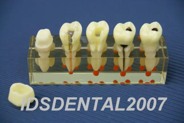 Dental Dentist Endo Endodontic Demonstration Model New