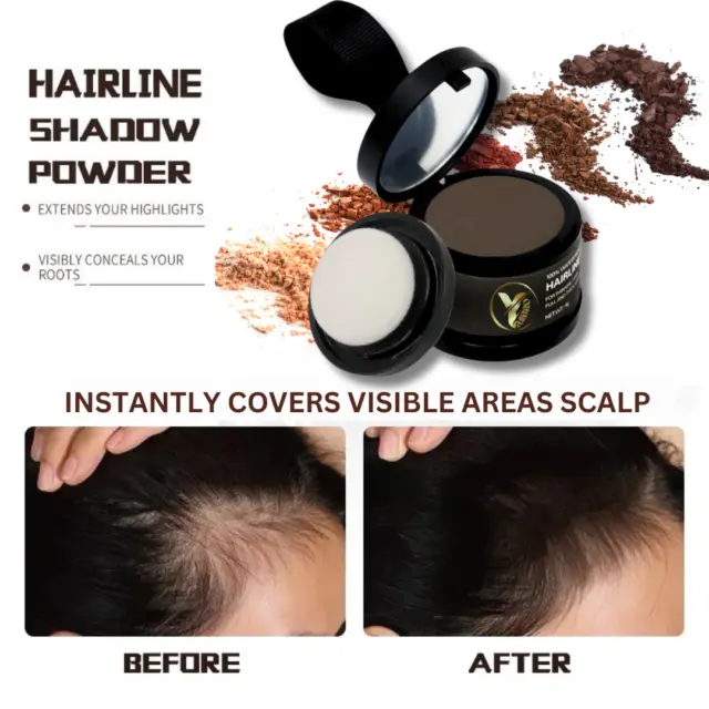 Hair Powder Cover Up Hairline Shadow Instant Concealer 🔥 TRUSTED UK BRAND 🔥