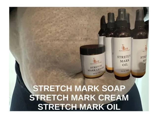 Stretch Mark Remover Repair Cream For Postpartum Pregnancy Scar  Skin Care