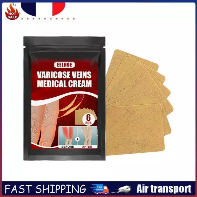 Effective Varicose Vein Relief Patch Body Leg Vasculitis Phlebitis Spider