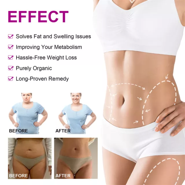 5/10/20 Pcs Wonder Patch Slimming Belly Abdomen Weight Loss Women Burning Fat