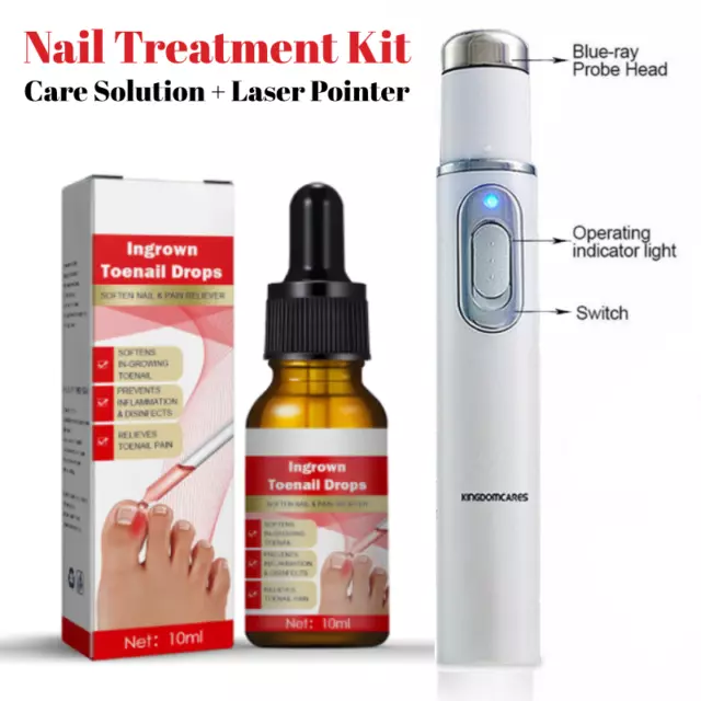 Anti-fungal Nail Treatment Kit Laser Pen Finger Toe Fungus Nail Care Liquid Kit~