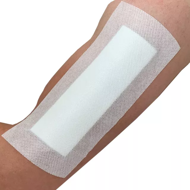 Pack of 25 Adhesive Wound Dressings - Suitable for cuts and grazes, Diabetic Leg