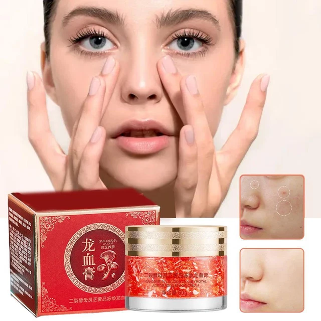 Crema de sangre de dragón crema facial lisa corrector de manchas ligeras crema de sangre para dama;