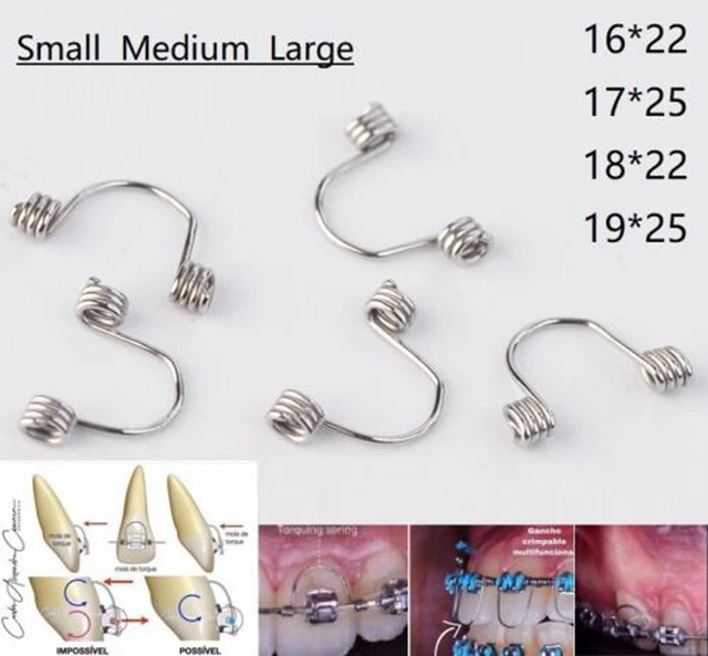 DENTAL ORTHODONTIC TORQUING Torque Spring Rectangular Anterior Teeth