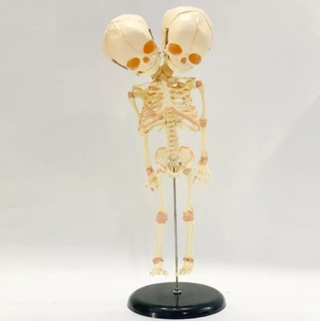 Mgm - Explora - Anatomie Squelette Corps Humain Transparent