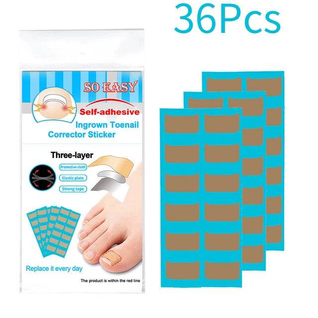 Autocollants de correction des ongles incarné des patchs correcteurs d'ongle