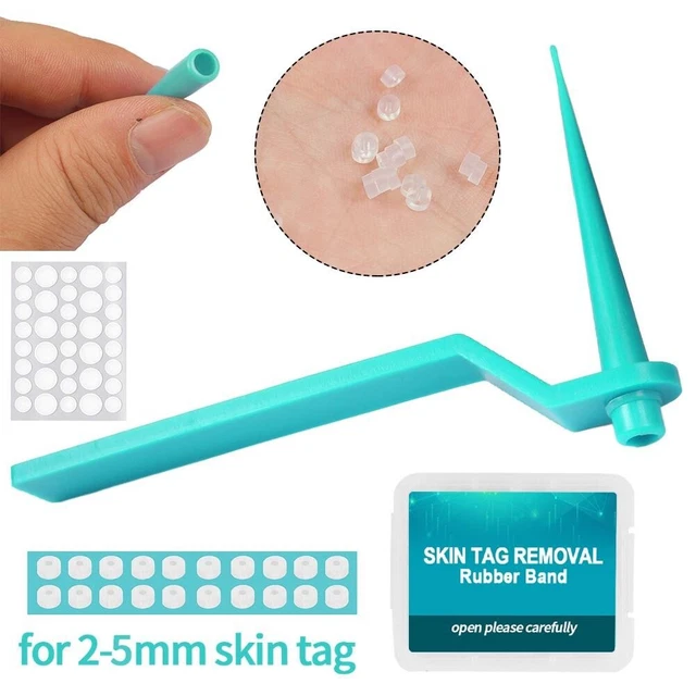 Recuperar la confianza con este kit de eliminación de etiquetas de piel 20 piezas bandas de goma incluidas
