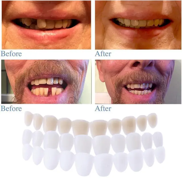 fr Silicone Simulated Tooth Cover Teeth Whitening Denture Paste Instant Smile