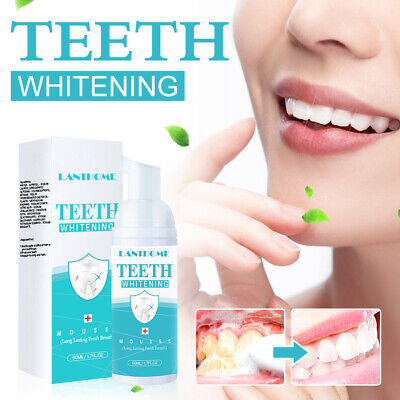 Blanqueamiento dental espuma pasta de dientes noble eliminación dientes limpieza profunda espuma ^ ☆