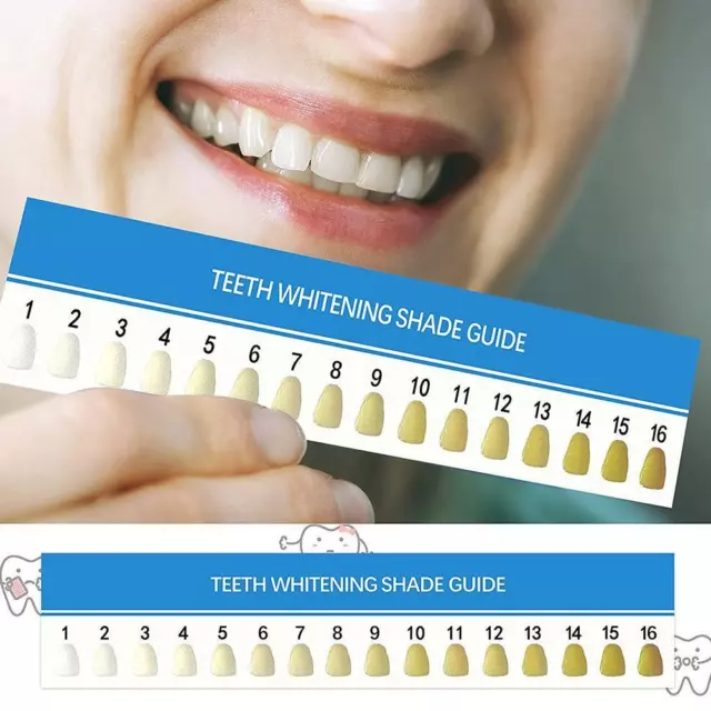 Teeth Whitening Guide Paper Teeth Whitening Chart Cards16Colors Effective U0S1