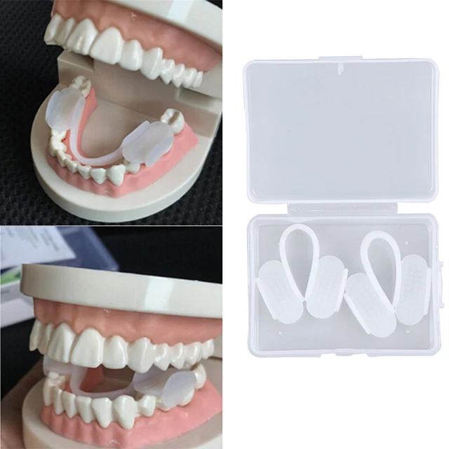 2pcs Dental Mouth Guard Bruxism Splint Teeth Grinding Sleep Aid Brace.FM