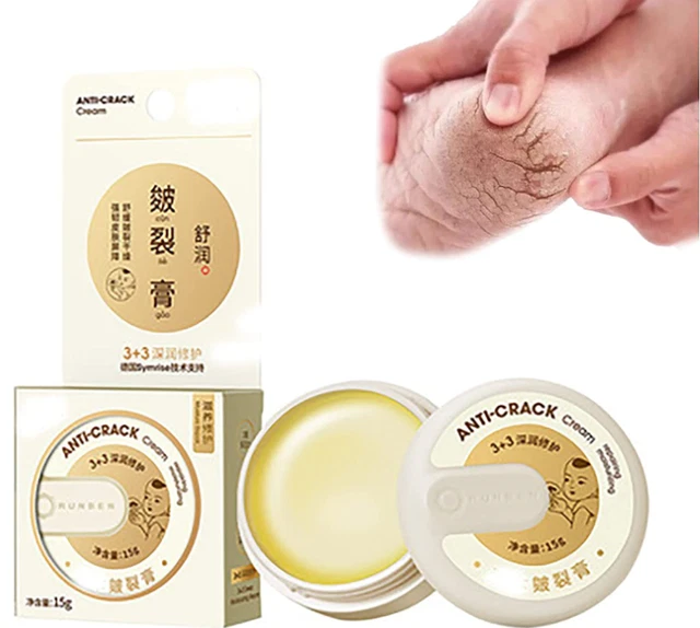 Crema para reparar la piel agrietada invierno 2022 crema para pies agrietados y grietas