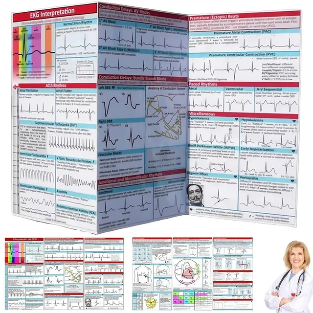 Ekg Library Examples DIY EKG POCKET Guide Cardiac Rhythm EKG Interpretation Book for Nurses ...