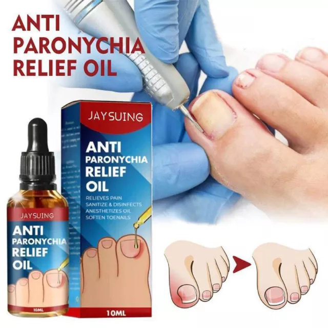 Tratamiento antiparoniquia aceite de alivio de hongos en las uñas de los pies ~