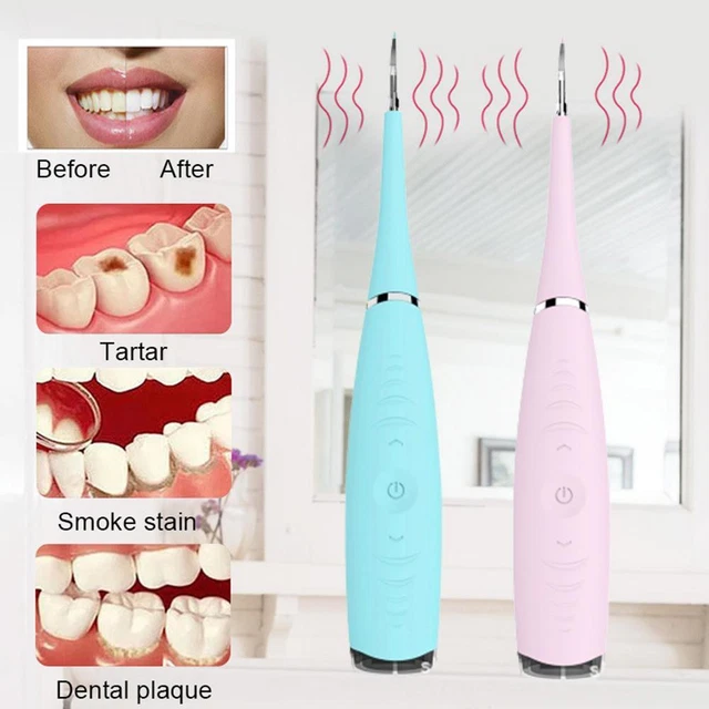 Electric Ultrasonic Tooth Cleaner Dental Scaler Stain Remover Teeth Cleaniu Electric Ultrasonic Tooth Cleaner Dental Scaler Stain Remover Teeth Cleaniu