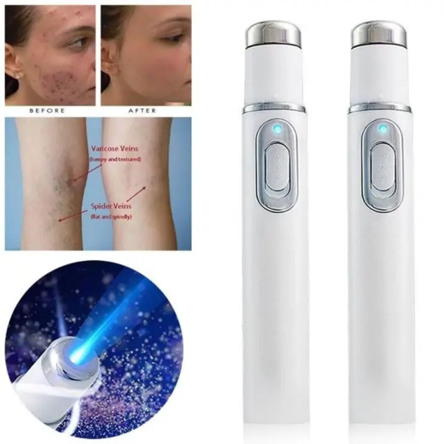 LCD Laser Plasma Pen Mole Dark Spot Skin Wart Tag Tattoo Removal Beauty Care Neu