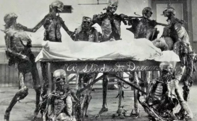 Antique Medical Cadaver Photo 205b Oddleys Strange & Bizarre