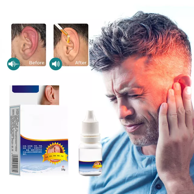 Gotas para los oídos de alivio del tinnitus 10 g para tratamiento de zumbido para tinnitus gota líquido sujetador