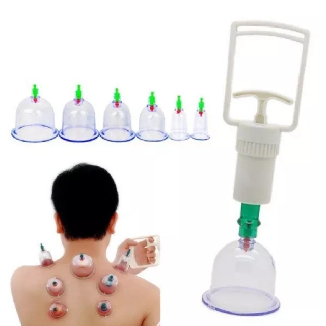 6 tazas de ventosas biomagnéticas terapia tradicional conjunto de ventosas kit de ventosas