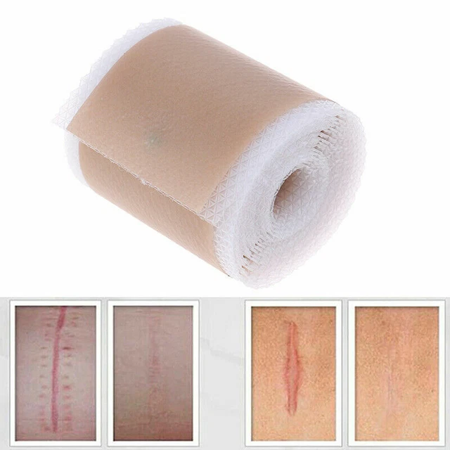 EFFICIENT SURGERY SCAR Removal Silicone Gel Sheet Patch Bandage Skin