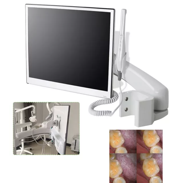 High-Definition Digital LCD AIO Monitor Dental Intra oral Camera DC-12V 17 Inch