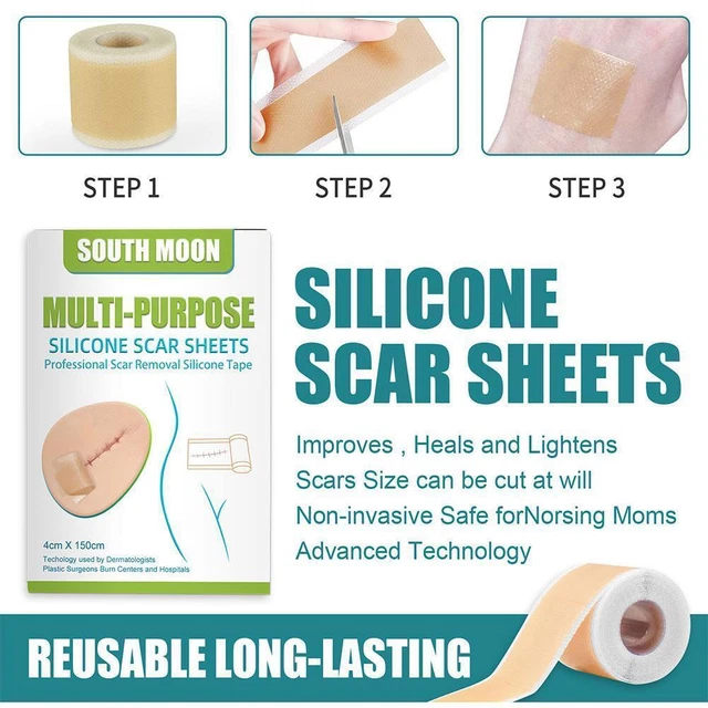Rimozione cicatrici lamiere adesive macchie gel di silicone cicatrici trattamento Hot Z3D3
