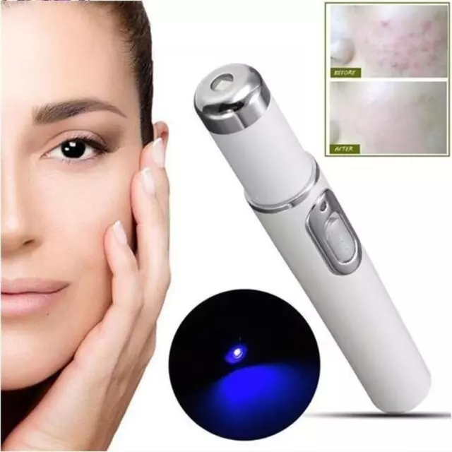 LCD Laser Plasma Pen Mole Dark Spot Skin Wart Tag Tattoo Removal Beauty Care DE 2