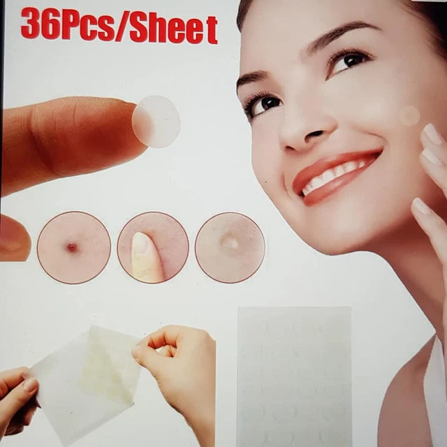 Crème De Traitement DONGAH Acnon 13g - Soin Coréen Anti-acné Rouge Et Purulente
