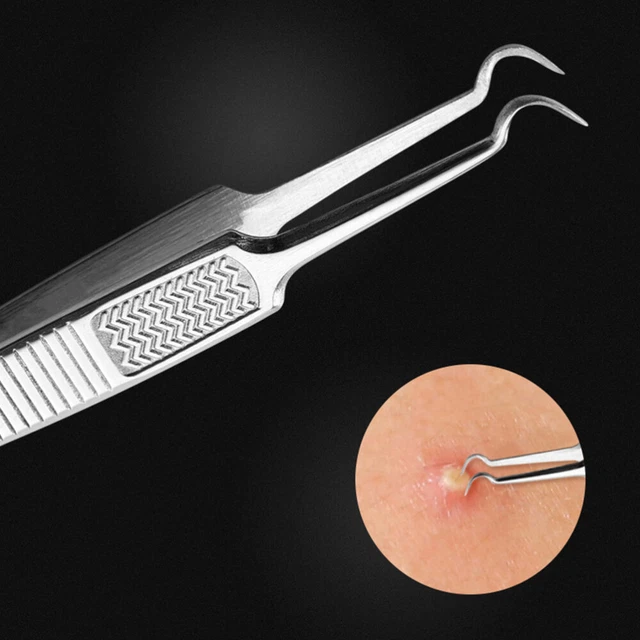 3 Pcs Akne Reinigung Pinzette Mitesser Extraktion Werkzeug Akne Remover Kit