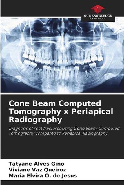 CONE BEAM COMPUTED Tomography x Periapical Radiography by Tatyane Alves ...