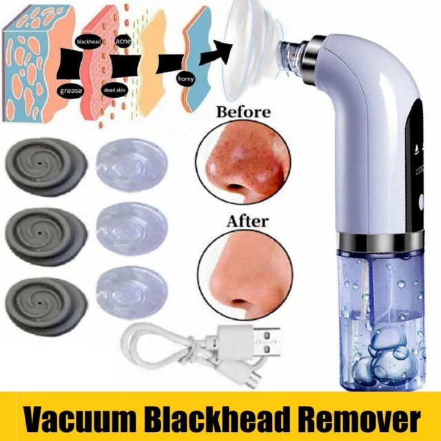 Electric Blackhead Remover Vacuum Pore Face Facial Suction Acne Cleaner Kit AU