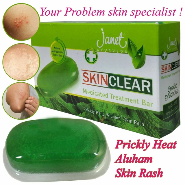ANTIFUNGAL SKIN HERBAL Soap Treats Prickly Heat Rash Tinea Versicol