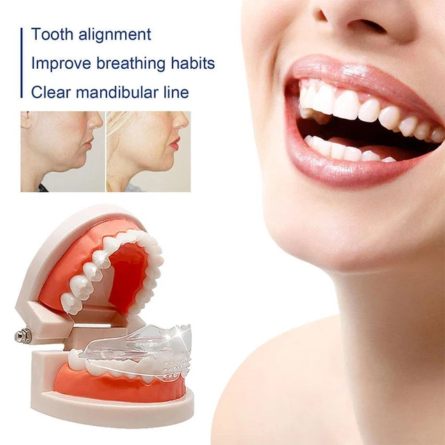 Dental Orthodontic Braces 3 Stages Silicone Jaw Alignment Kids Trainer η T4E4
