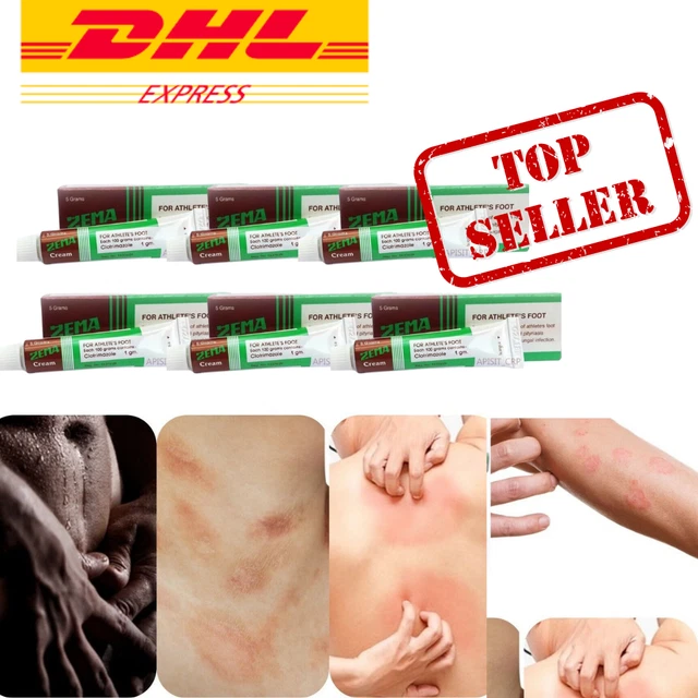 FOOT ITCHY HEAL Body Scratch Rash Care Cream Zema X6 EUR 56,16 ...