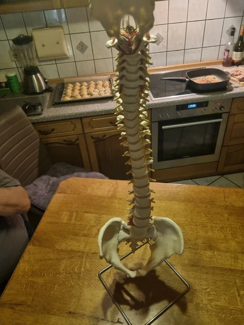 älteres medizin modell wirbelsäule   Scheunenfund/ Kellerfund/ Dachbodenfund