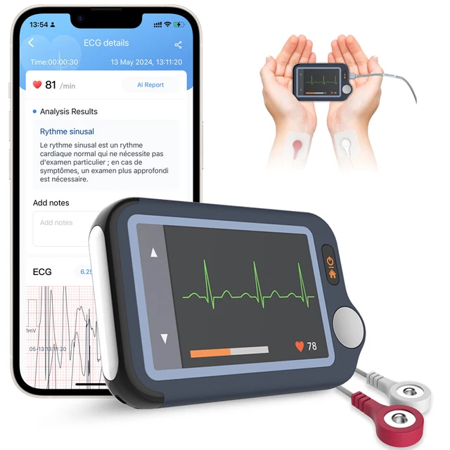 EKG ECG MONITOR 30s/60s/5min Recording AI-ECG Analysis Report in App PC ...