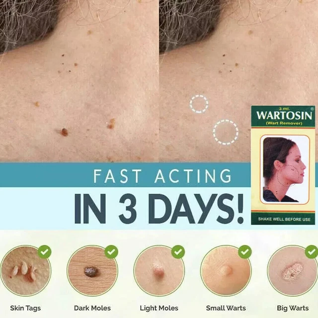 Ideal Vacuum | Pfeiffer Alcatel Adixen Pascal, Les pompes à vide
