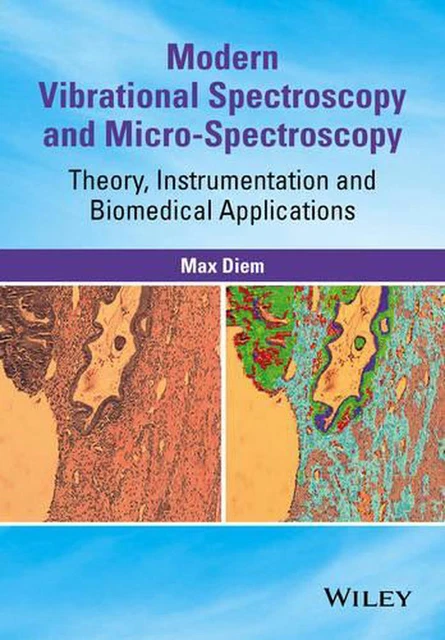 Modern Vibrational Spectroscopy and Micro-Spectroscopy: Theory, Instrumentation